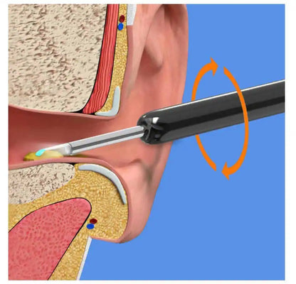 Earwax Removal Kit